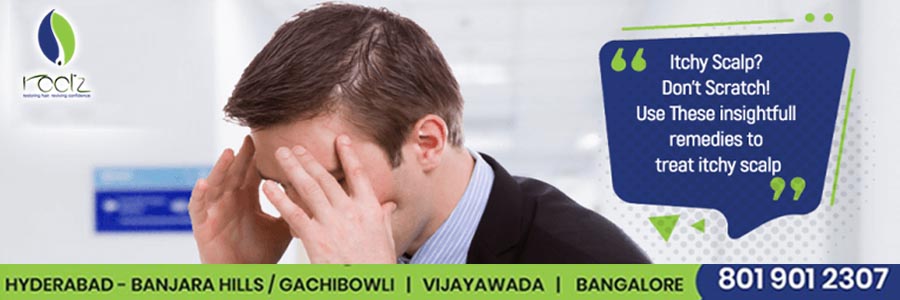Itchy Scalp Dont Scratch Use these insightful remedies to treat itchy